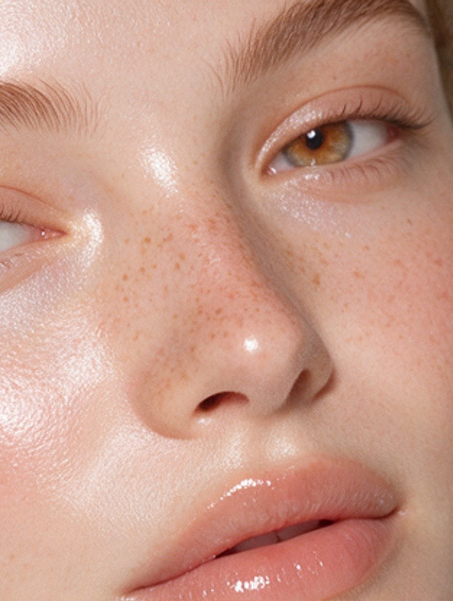 Dewy freckled skin in daylight